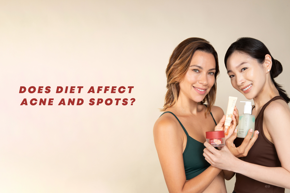 Does Diet Cause Acne And Spots S I G I S K I N does-diet-cause-acne-and-spots-s-i-g-i-s-k-i-n
