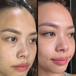 Daylight Oasis Vitamin C Serum Before After Testimonial 2