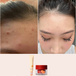 Garden Party Deep Cleansing Clay Mask Before After Testimonial