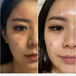 Tea-Tox Sheet Mask Before After Testimonial